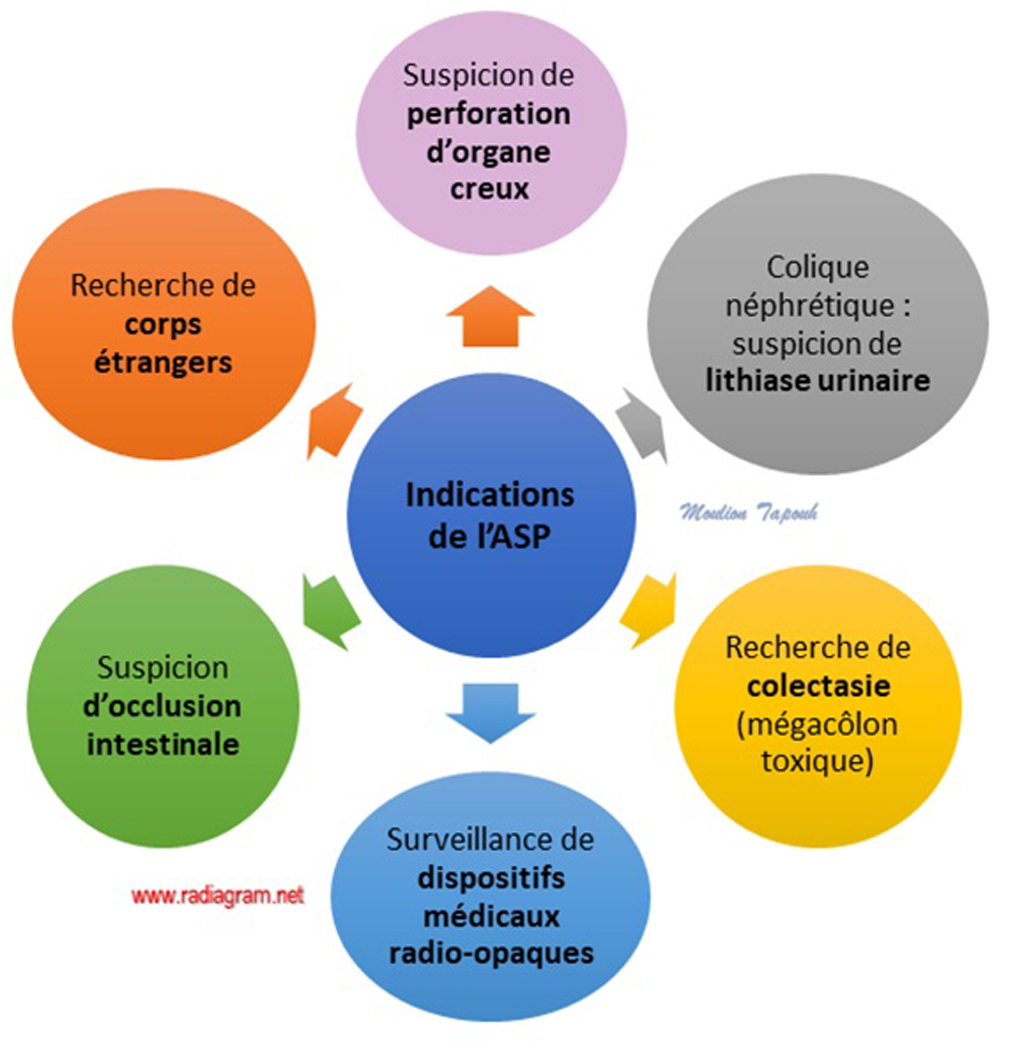 découvrez notre guide complet sur la comptabilisation asp d'avril, qui vous fournit des conseils pratiques et des astuces pour optimiser vos enregistrements comptables. parfait pour les professionnels de la comptabilité souhaitant améliorer leur efficacité et conformité.